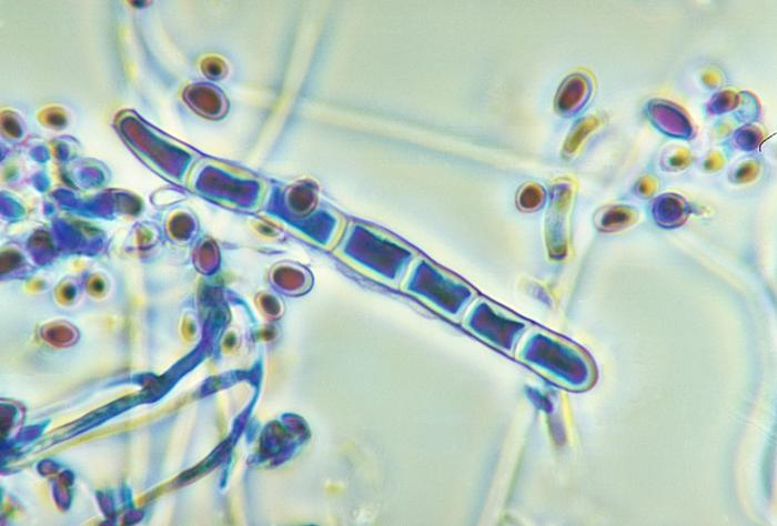 El dermatofito trichophyton rubrum, es un hongo microscópico obligado antropofílico (del que el ser humano es huésped primario), que pueden infectar de forma ocasional a perros y gatos causando una zoonosis reversible. 