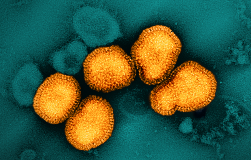 Virus influenza A Virus (H3N2)