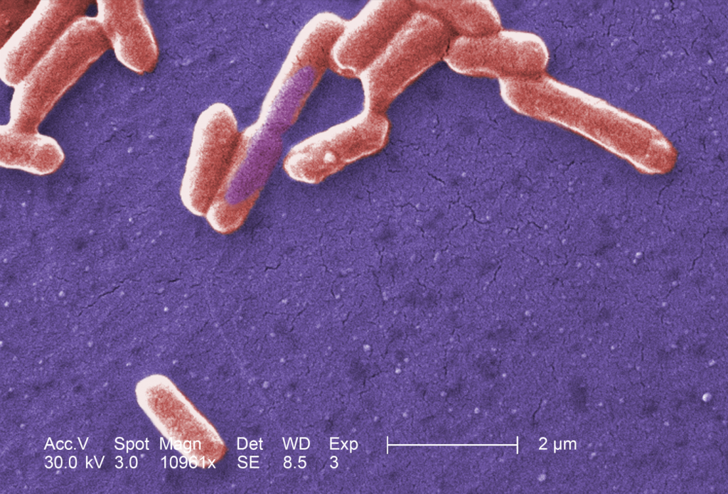 Escherichia coli de la cepa O157:H7.  Aunque la mayoría de las cepas son inofensivas y viven en los intestinos de humanos y animales sanos, hay cepas, cómo ésta, que pueden causar enfermedades graves