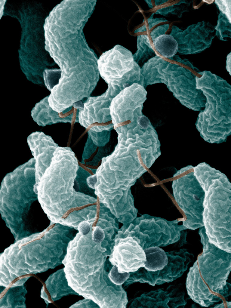 Células de bacteria campylobacter jejuni. Campylobacter son bacilos, por lo general con forma espiralada, de S o curva. 