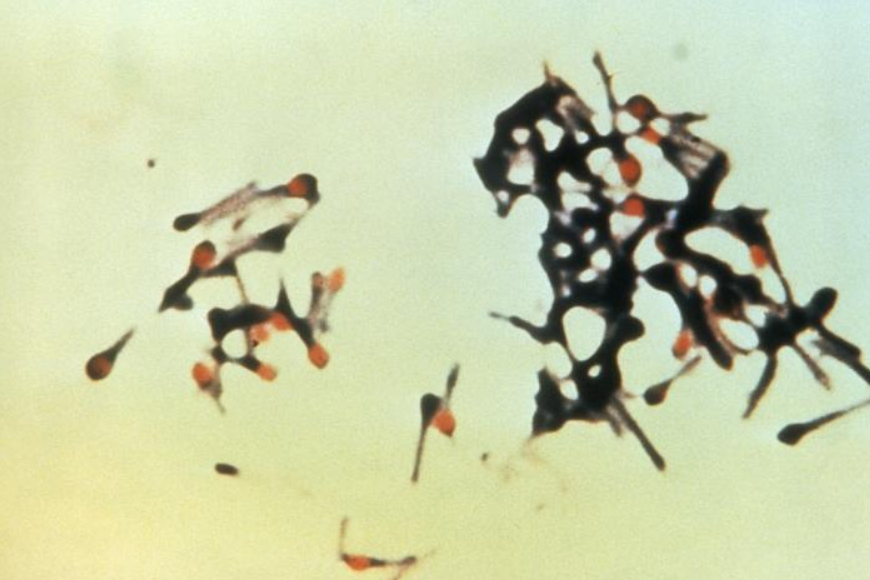 La bacteria clostridium tetani, es responsables de causar el tétanos