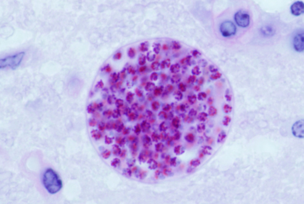 toxoplasma gondii en cerebro de ratón